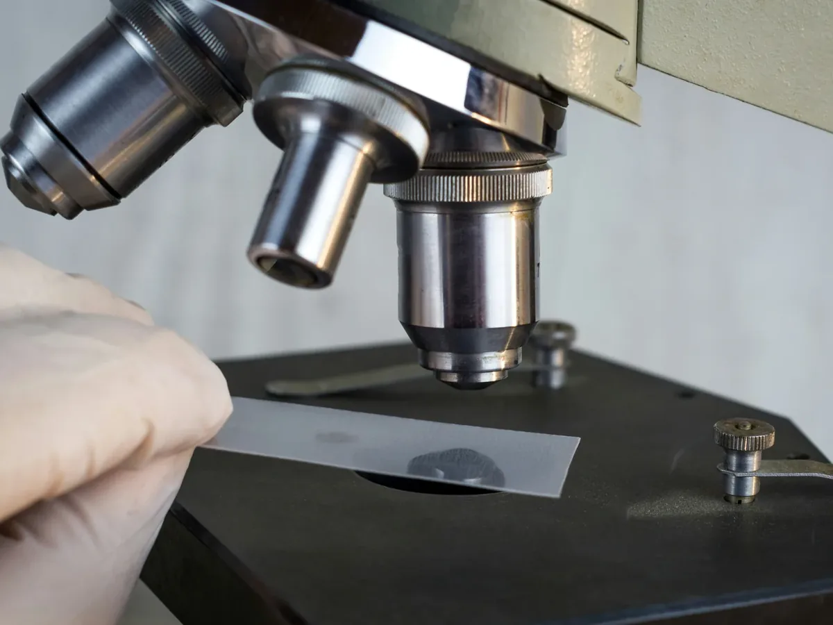 Erkek infertilitesi ve sperm değerlendirmesi